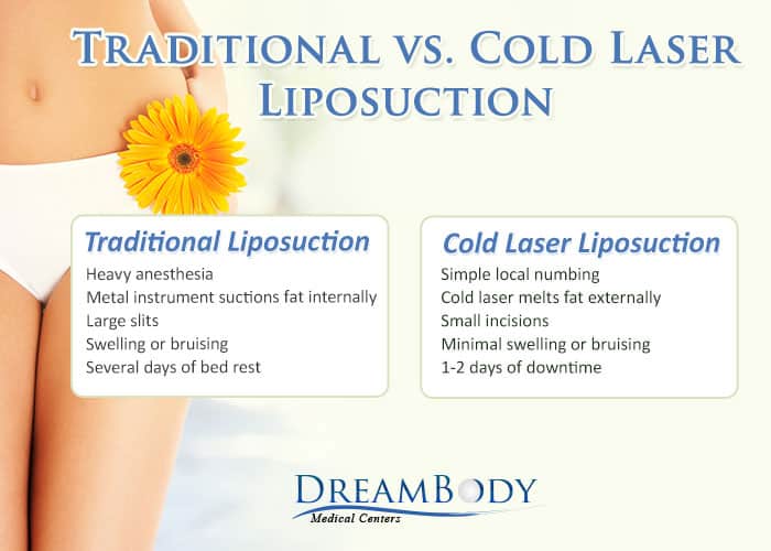 Traditional Liposuction vs. Cold Laser Liposuction